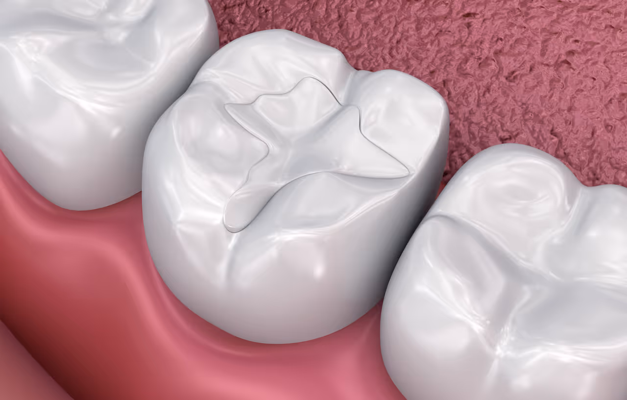 What Are the Benefits of White Filling?